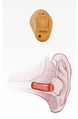 CIC deep ear canal hearing aid