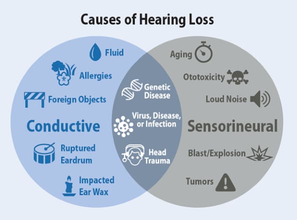 Causes of hearing loss