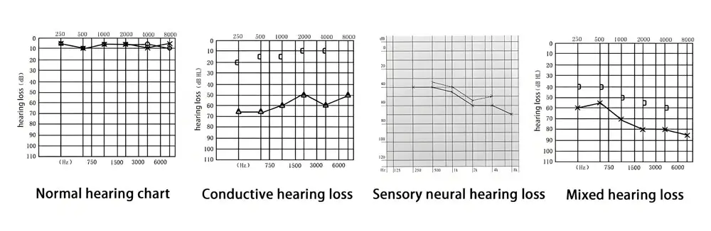 Different audiogram maps