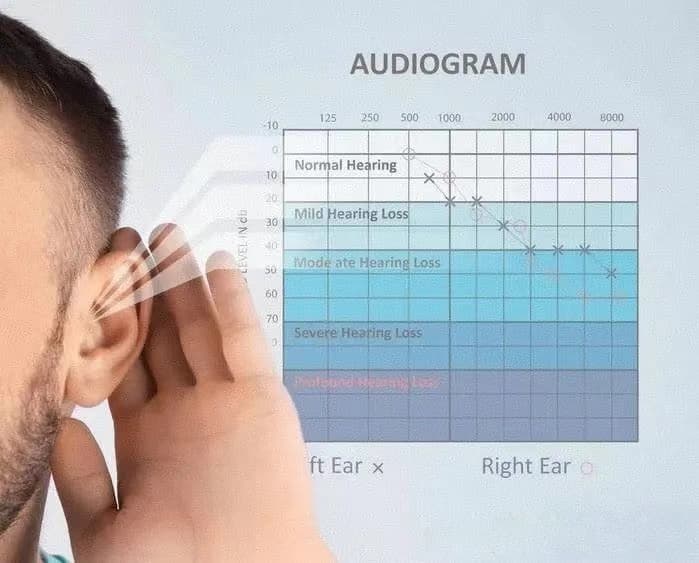 Hearing loss of varying degrees