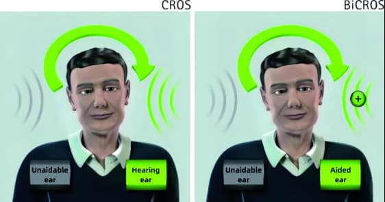 Working principle of CROS and Bi-CROS